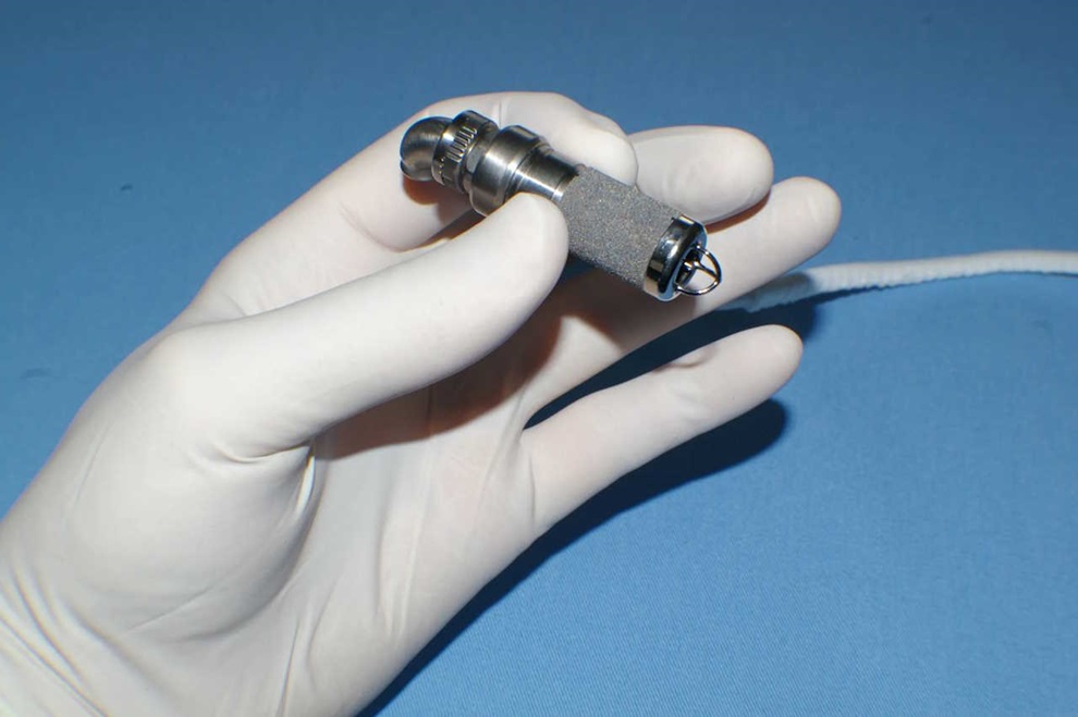 Imagen: El dispositivo de asistencia ventricular implantable puede soportar el corazón que fallan en un niño (foto cortesía de Jarvik Heart, Inc.)